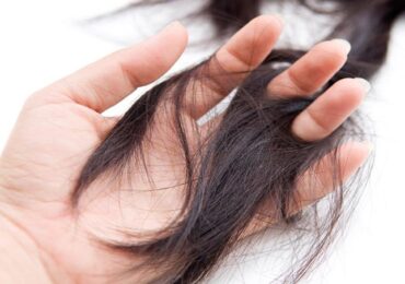 Thiếu máu thiếu sắt và rụng tóc có mối liên hệ gì không?