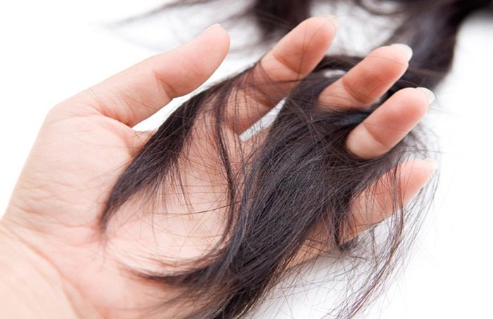 Thiếu máu thiếu sắt và rụng tóc có mối liên hệ gì không?