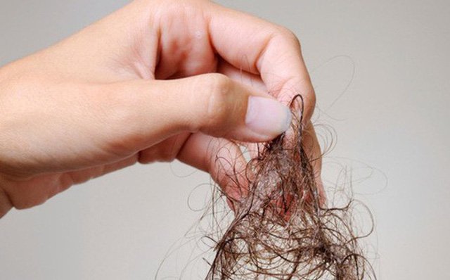 Rụng tóc nhiều khi gội đầu phải làm sao?