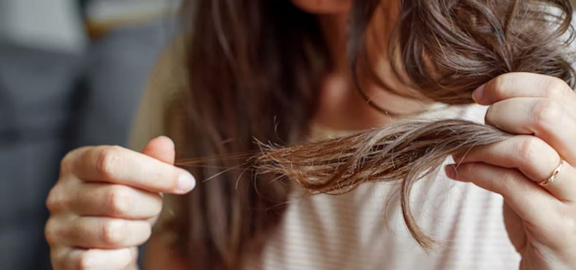 Thiếu ngủ ảnh hưởng như thế nào đến rụng tóc?