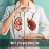 Thận yếu gây rụng tóc
