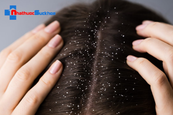 Tóc rụng có hạt trắng ở chân tóc có gây nguy hiểm không?