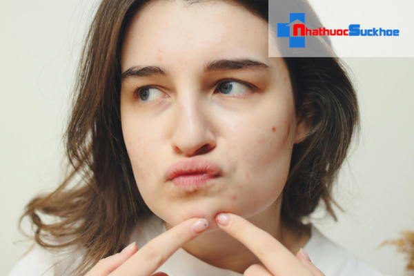 Dưỡng ẩm cho da mụn