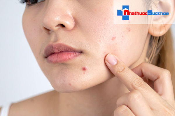 Làm sạch da đúng cách