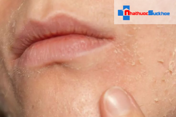 Những sai lầm thường gặp khi chăm sóc da