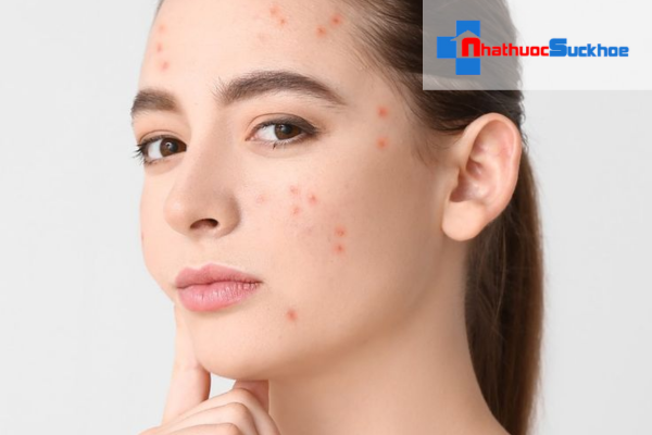 Sử dụng serum đặc trị