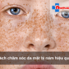 Cách chăm sóc da mặt bị nám hiệu quả