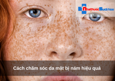 Cách chăm sóc da mặt bị nám hiệu quả