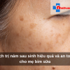 Cách trị nám sau sinh hiệu quả và an toàn cho mẹ bỉm sữa