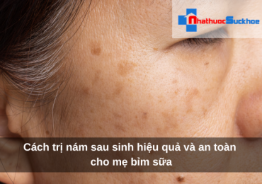 Cách trị nám sau sinh hiệu quả và an toàn cho mẹ bỉm sữa
